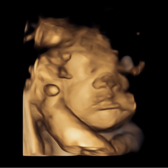 “At The End of Every Storm Is a Rainbow” - Picture 1 of 17